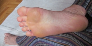 My foot: not a thing of great beauty, but it's free of cracks and callouses!